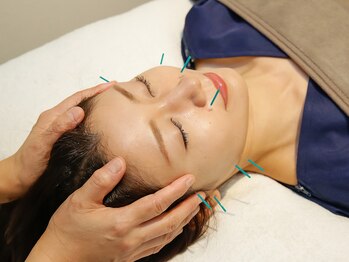 ツボプロ 梅田院の写真/初めての美容鍼灸におすすめ！優しい鍼と温かいお顔専用灸で心も身体も癒やされる体験を♪