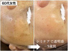 パールホワイトニングサロン 辻堂店の雰囲気（ハーブピーリング（ダウンタイムあり/なし）で透明感ある素肌へ）