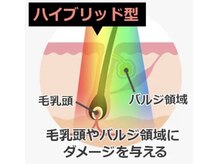 脱毛サロン バニスティの雰囲気（完了まで早いIPL×SHRハイブリッド脱毛機器を使用！）