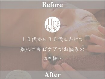 ハーバリー ハーブピーリング 大阪梅田店(HERBERRYハーブピーリング)/梅田ハーブピーリングHERBERRY