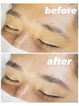 メンズー(MENZOO)/ハリウッドブロウリフト