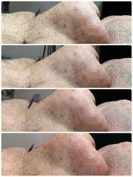 グリーン(green)/全部before!!