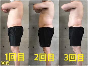 ペリー(PELLY)/男性30代 before after