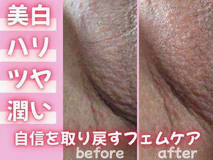 フェミニン(Feminine)の写真
