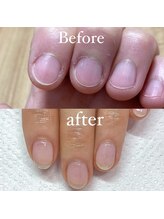 メリーミー(Merry me)/自爪育成