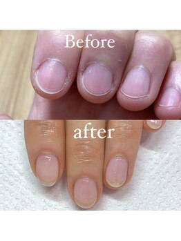 メリーミー(Merry me)/自爪育成