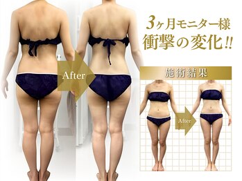 レイビス 札幌店(RAYVIS)/お客様ビフォーアフター