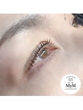 マイム(MyM)/施術例