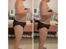 ムーンブロッサム(MoonBlossom)/脂肪燃焼上半身集中120分