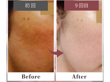 フルリール/【UVプロテクション】