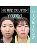 【5月限定でお得】"赤みゼロ"のハーブピーリング♪お出かけ前に手軽に美肌へ