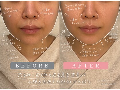 ステラグランデ(Stella grande)の写真