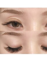 クリアーズ ビューティー(CCLEAR’S BEAUTY)/バインドロック