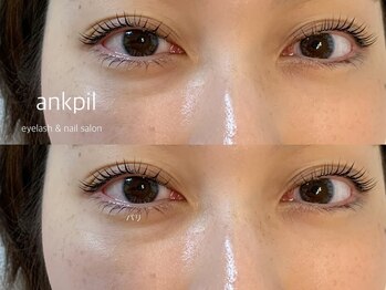 アノカプイル(ankpil)/【パリジェンヌ】