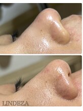 リンデザ(LINDEZA)/メイクノリも最高