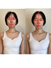 カラダミックス(karadamix)/顔の歪みケア