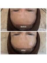 グレイス(Grace)/