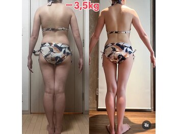 レナトゥス 銀座(Renatus)/ブライダル痩身