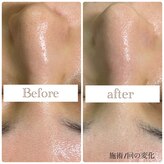 ルフローラ(Ruflora)