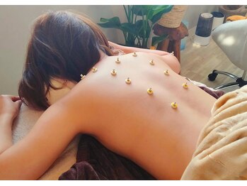 ナチュラルハリー(NaturalHarry)の写真/体質を分析し、刺さない美容鍼と温かいお灸、リンパマッサージで心と体をやさしく整えます