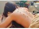 ナチュラルハリー(NaturalHarry)の写真/体質を分析し、刺さない美容鍼と温かいお灸、リンパマッサージで心と体をやさしく整えます