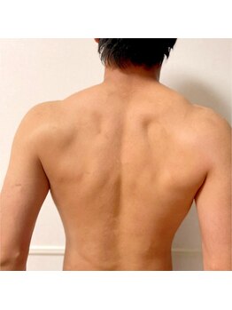 リ シャルム(Re Charme)/男性の濃い毛もツルツルに!!