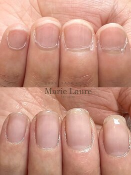 マリーロール 梅田店(Marie Laure)/自爪育成/深爪矯正/ネイルケア
