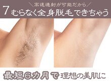 つるピカ 新宿店/7 最短6カ月で全身脱毛 完了
