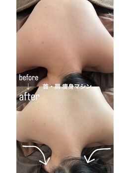 ラ ブリエ(La Briller)/首・肩も即日スッキリ!