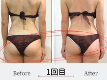 エミフル(emifull)/美骨ボディ・50代のお客様