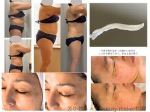 ビューティーメーカー 桜舞(Beauty maker)の雰囲気(技術ももちろんですが、使用商材もこだわりあり☆ダイエット痩身)