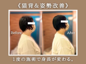 リカバリア(Recoveria)/猫背＆姿勢改善