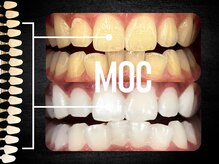 モック 麻布十番(MOC)/ホワイトニング/麻布十番/六本木