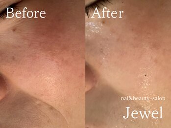 ジュエル(Jewel)/マグマハーブ一回の効果