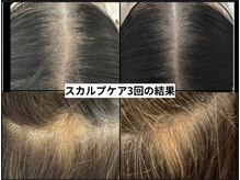 リアリア(LEALEA)の雰囲気（分け目、円形も3回の結果です）