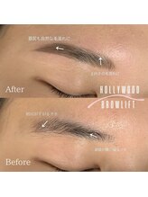 エイミー(Amy)/HOLLYWOOD BROWLIFT