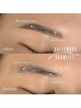 エイミー(Amy)/HOLLYWOOD BROWLIFT