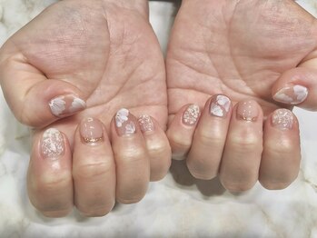 ヴィプラス(Vi+)/