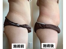 サロン サルー(SALON Salud)/◇