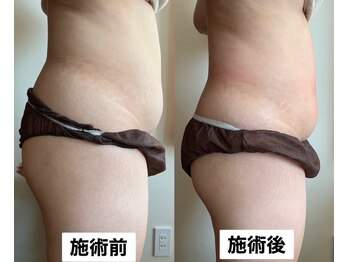 サロン サルー(SALON Salud)/◇