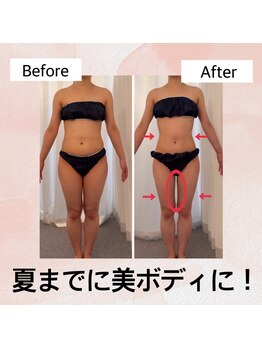 リュクス  Luxe＋tkm 南船場/エンダモロジーは美肌にも！