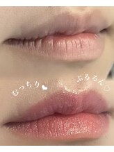 オンユ(ON’U)/ローマピンク