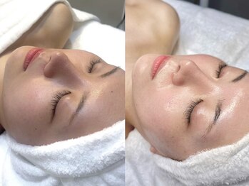 ミュー 自由が丘店(mieux)/スペシャルケアコース