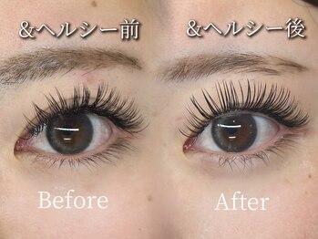 バタフライ 武蔵小杉店(Butterfly)/アンドヘルシー×バインドロック