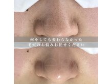 ミラボ(melab)