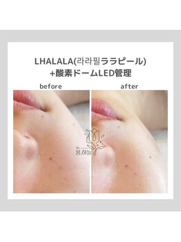 ポムハヌル(pom.haneul)/韓国肌管理室