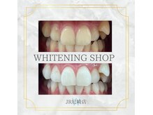 ホワイトニングショップ 尼崎店/ホワイトニング