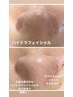 【毛穴の黒ずみ/ざらつき】毛穴洗浄すっきりもっちり肌へ　11,000円→9,900円
