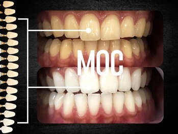 モック 麻布十番(MOC)/ホワイトニング/麻布十番/六本木