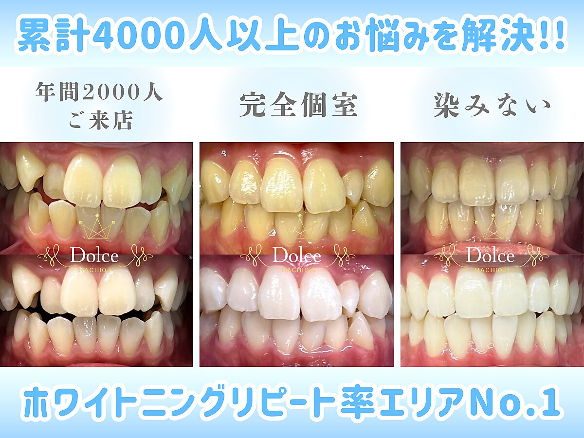 ドルチェ 水戸店(Dolce)｜ホットペッパービューティー